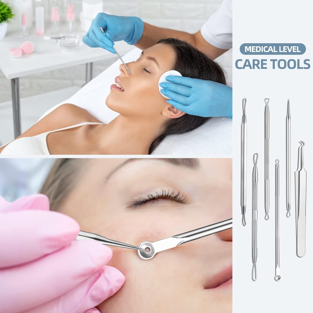 Blackhead Remover Tool - Achieve a Clear Face with the JPNK Blackhead Removal Kit 1