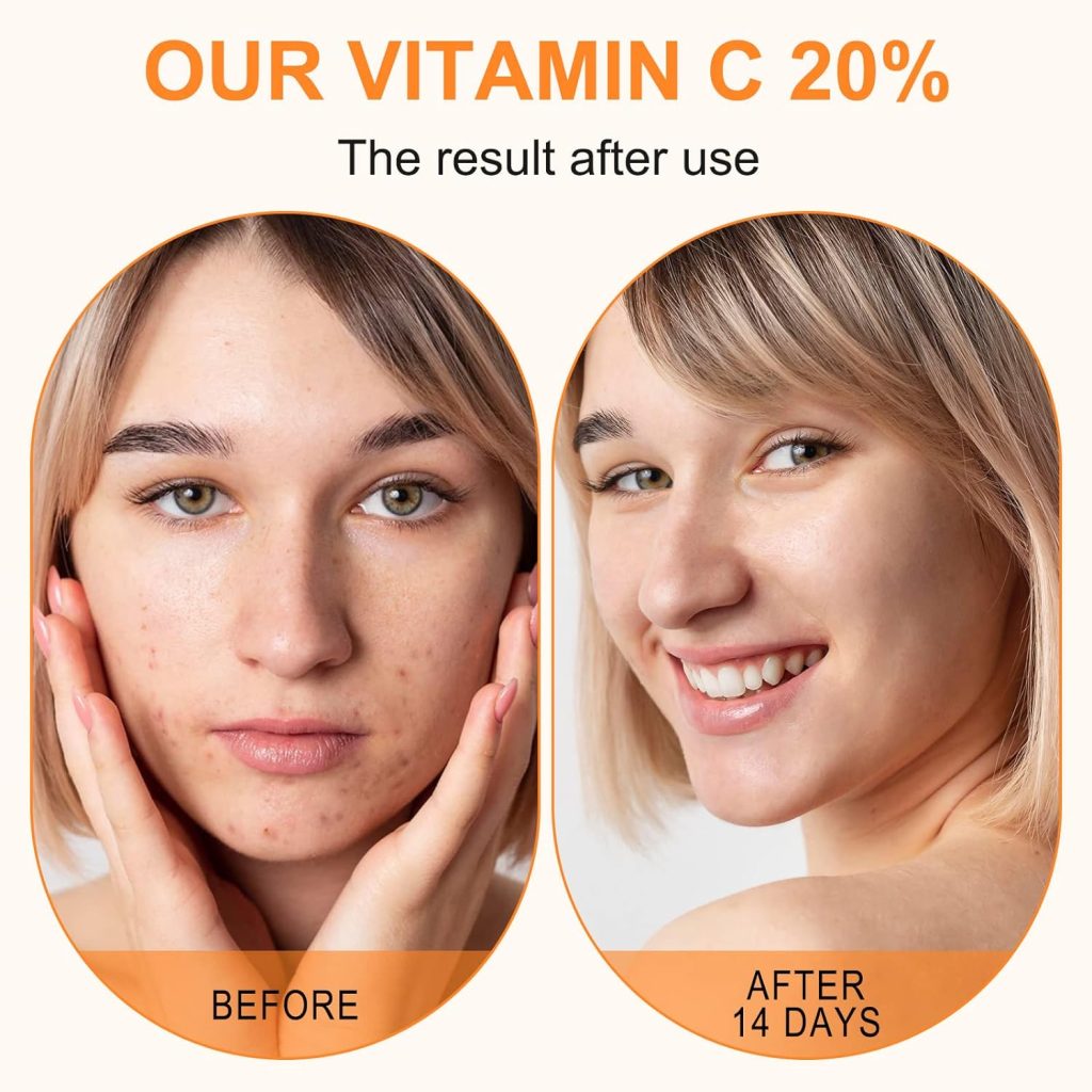 Boost Skin Collagen with Premium Vitamin C Serum 2